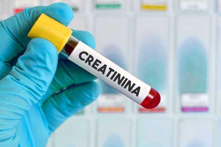 Teste de ureia e creatinina | Dr. Elias El Mafarjeh | Pediatra em São Paulo
