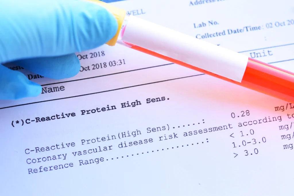 Teste de Proteína C Reativa PCR | Dr. Elias El Mafarjeh | Pediatra