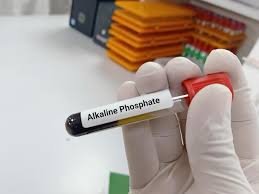 Teste de fosfatase alcalina | Dr. Elias El Mafarjeh | Pediatra em SP